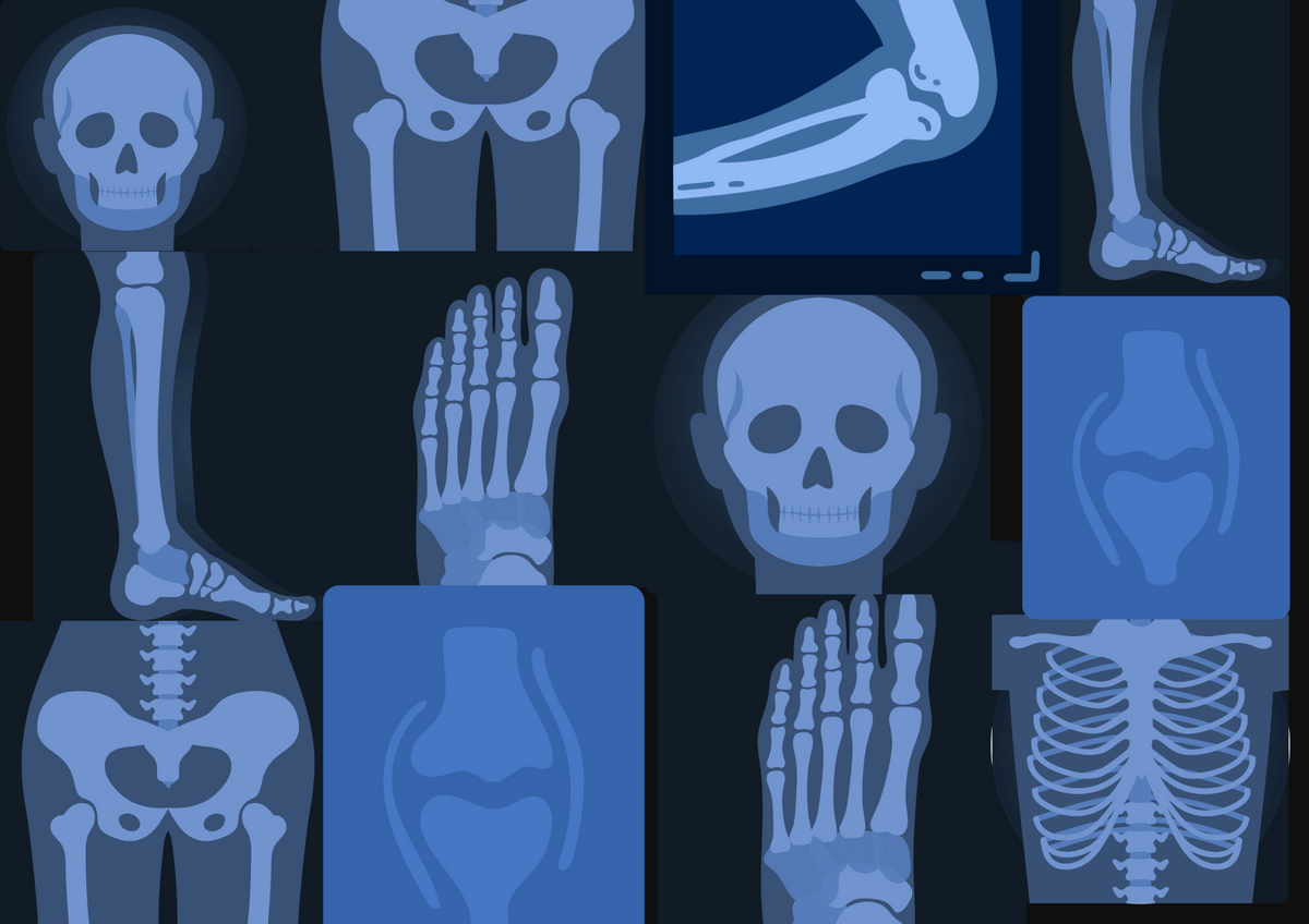 ORTHOPAEDICS